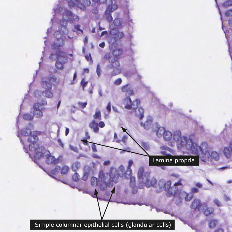 Dictionary Normal Gallbladder The Human Protein Atlas