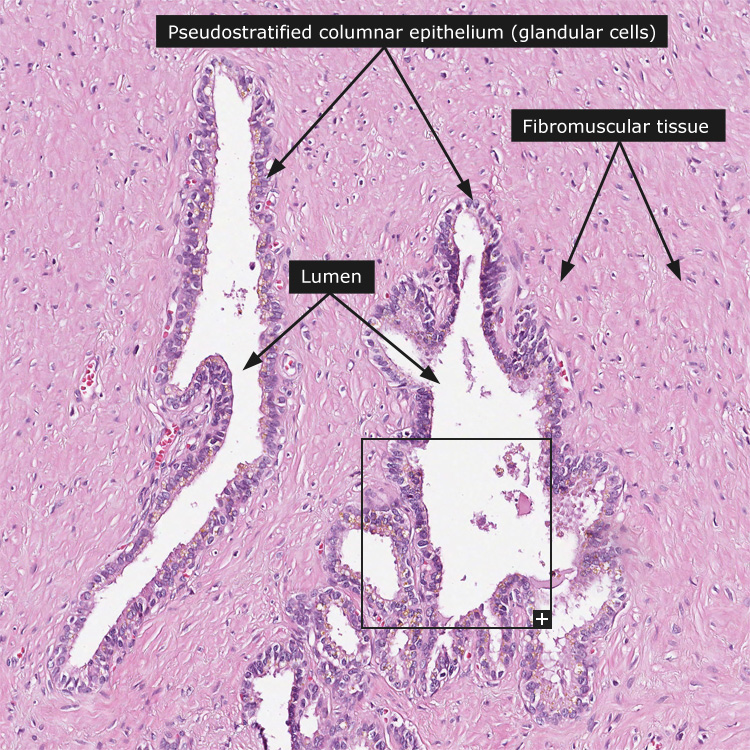 Dictionary - Normal: Seminal vesicle - The Human Protein Atlas