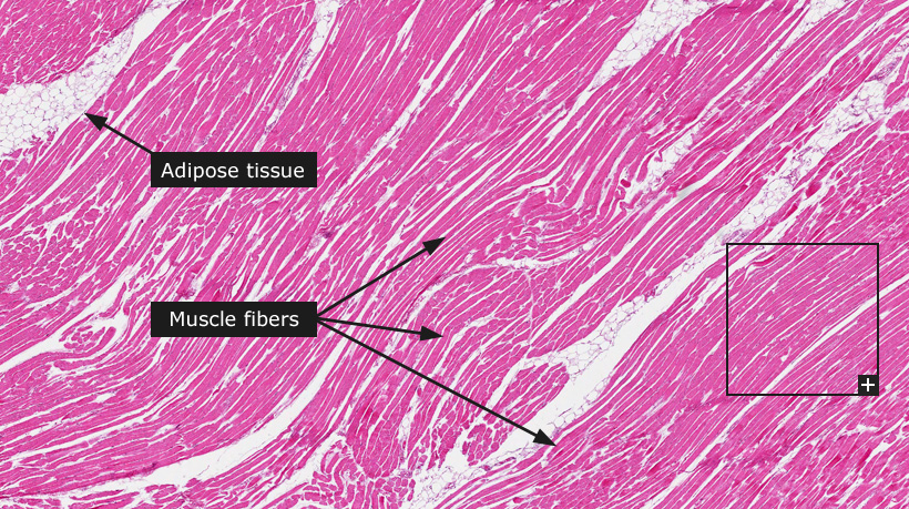 skeletal muscle under microscope labeled