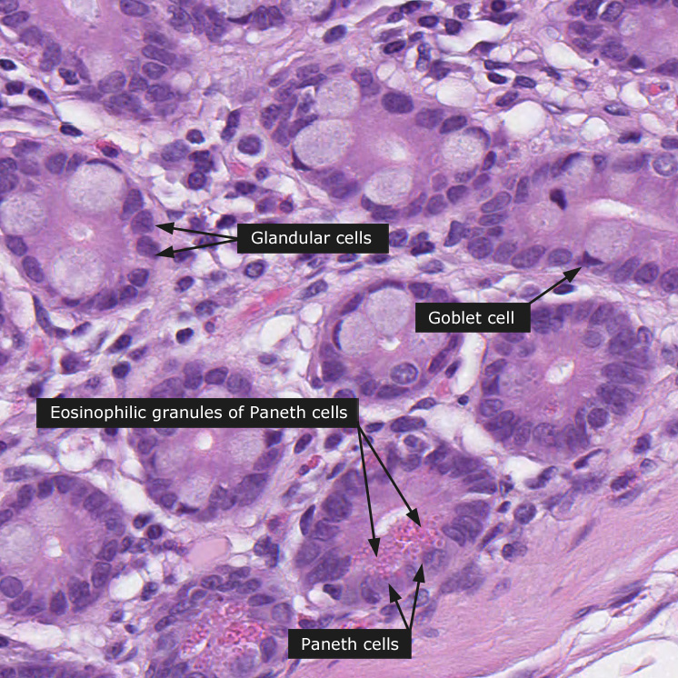 Dictionary - Normal: Small Intestine - The Human Protein Atlas