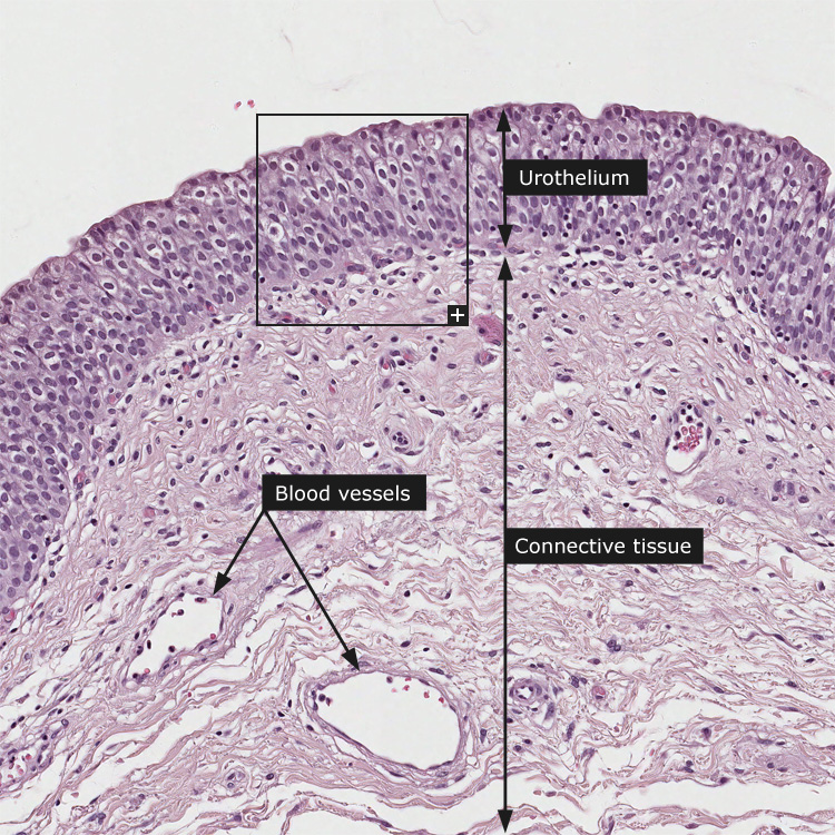 Dictionary - Normal: Urinary bladder - The Human Protein Atlas